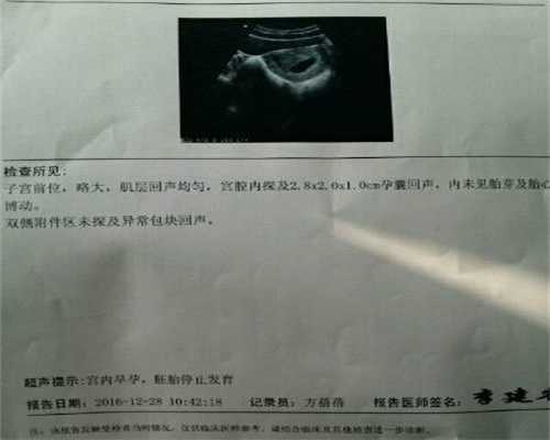 北京代孕八个月能坐高铁吗，北京代孕前三个月