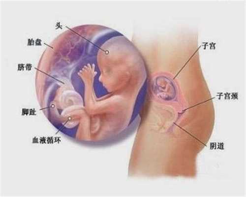北京代孕后有褐色分泌物是怎么回事？