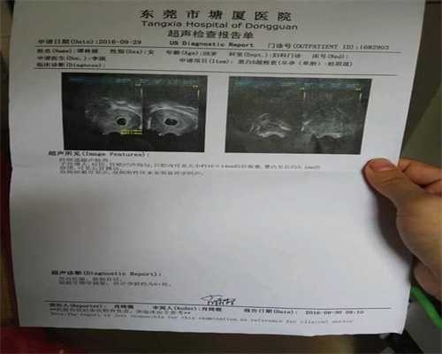 北京代孕五个月胎动情况 如何正确数胎动
